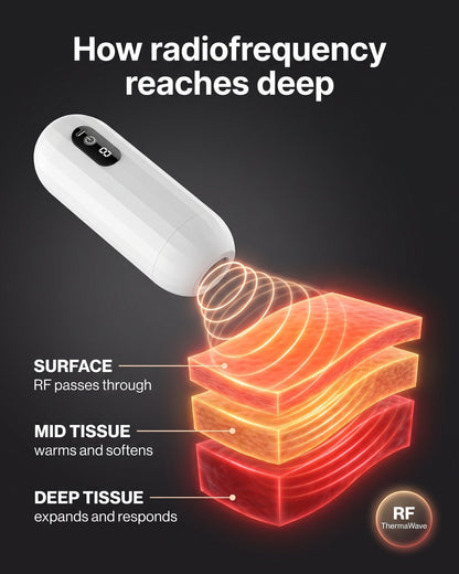 Virex™ Pro
